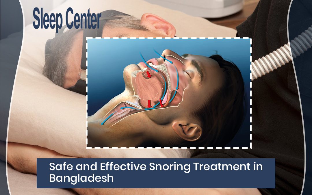 Safe and Effective Snoring Treatment in Bangladesh